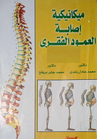 Image of ميكانيكية اصابة العمود الفقري