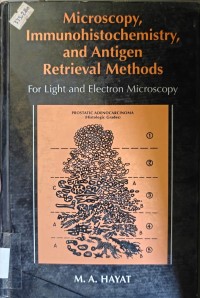 Image of MICROSCOPY IMMUNOHISTOCHEMISTRY AND ANTIGEN RETRIEVAL METHODS